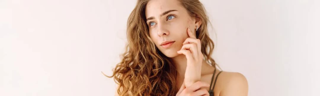 Skuteczny krem na niedoskonałości cery – pozbądź się wyprysków i przebarwień